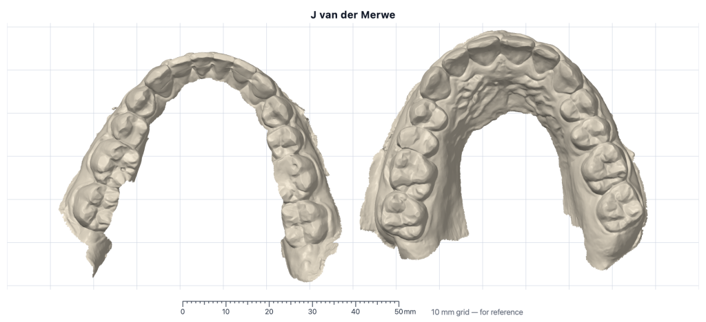 Occlusal view: lower and upper arches side by side on a 10 mm grid with a ruler